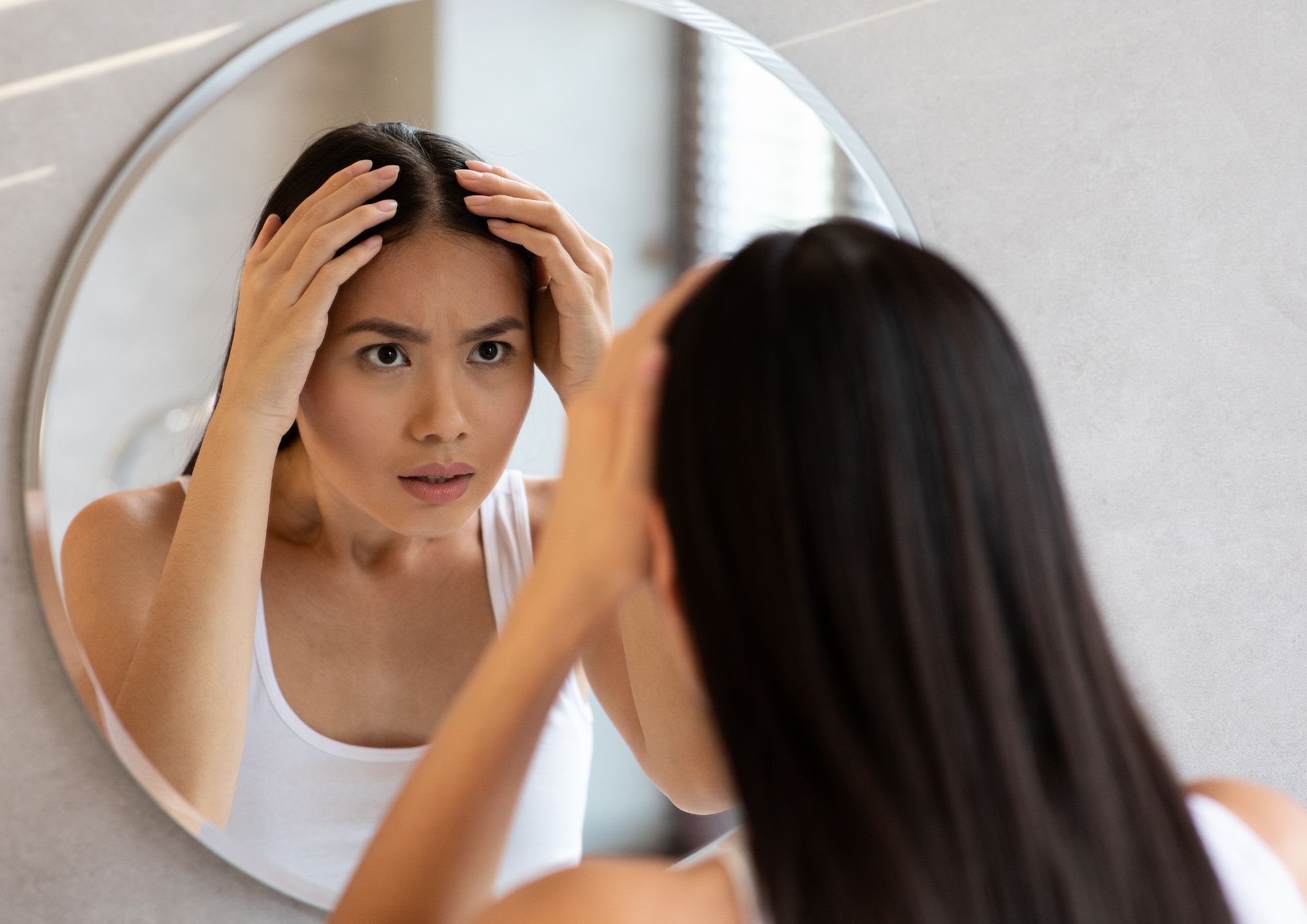 hair loss