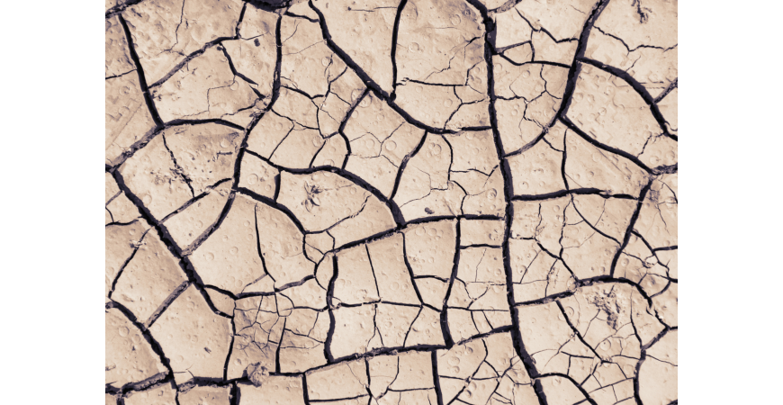 Dry Scalp Mistakes You Could Be Making And How to Fix Them