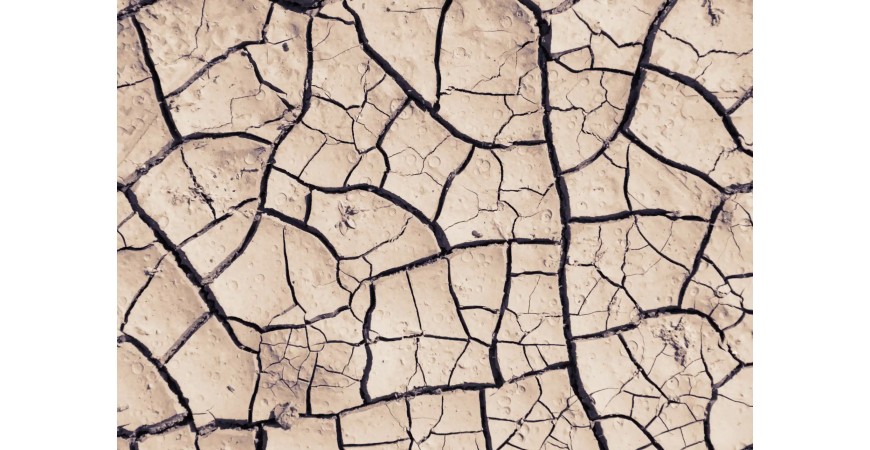 Dry Scalp Mistakes You Could Be Making And How to Fix Them